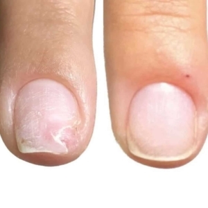 NAILSOFTHEDAY ONISTOP regenerating nail oil