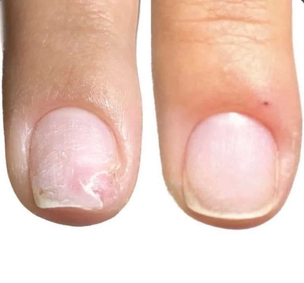 NAILSOFTHEDAY ONISTOP regenerating nail oil