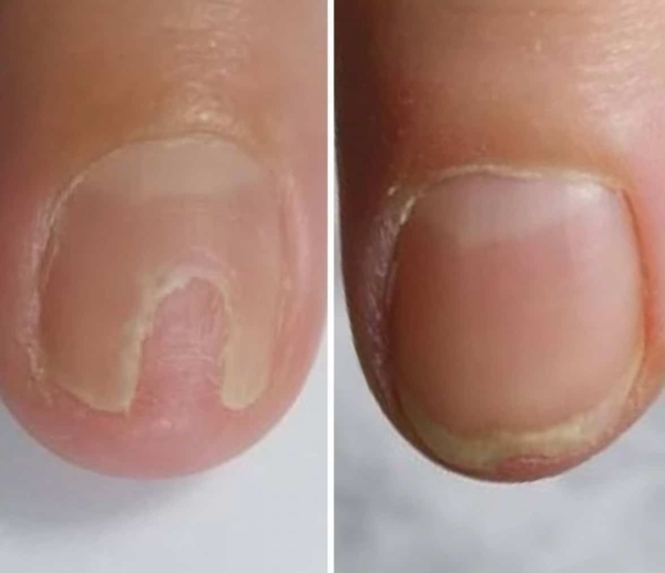 NAILSOFTHEDAY ONISTOP regenerating nail oil